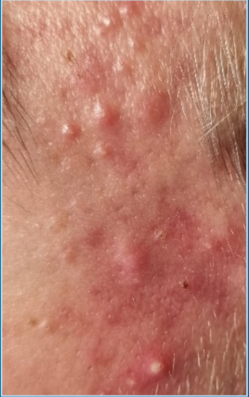 Huidtherapie franeker